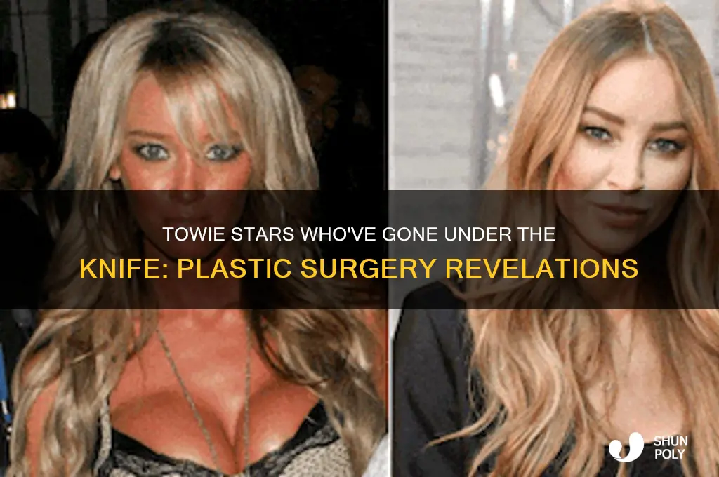 who has had plastic surgery in towie