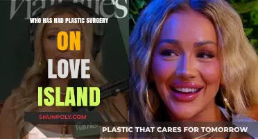 Love Island Stars Who've Gone Under the Knife: Plastic Surgery Revelations