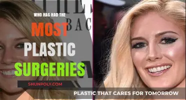 Unveiling the Record: Celebrities with the Most Plastic Surgeries