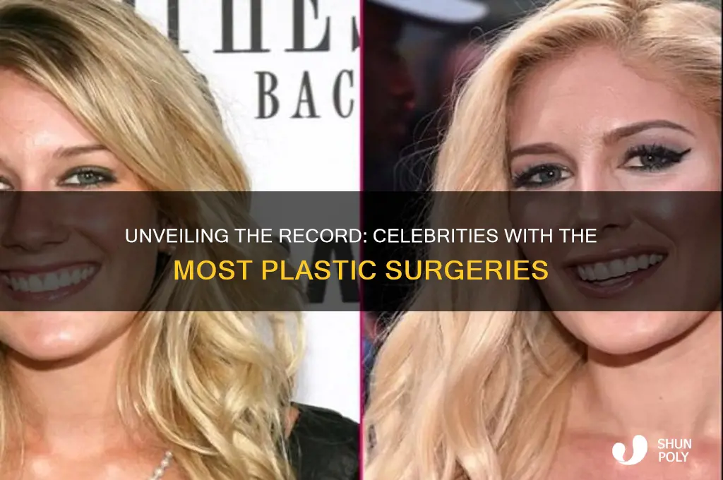 who has had the most plastic surgeries