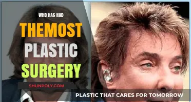 Unveiling the Most Transformed: Celebrities with Extensive Plastic Surgery