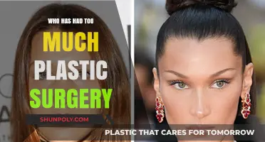 Excessive Plastic Surgery: Celebrities Who’ve Gone Too Far