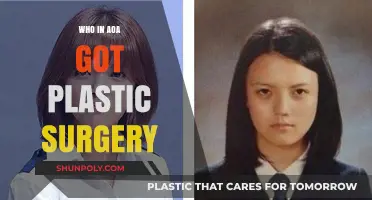 AOA Members' Plastic Surgery: Who Enhanced Their Features?