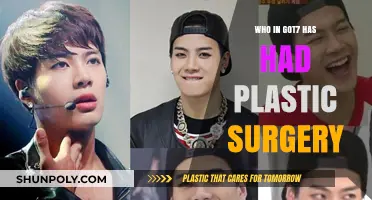 GOT7 Plastic Surgery Speculations: Who's Had Work Done?