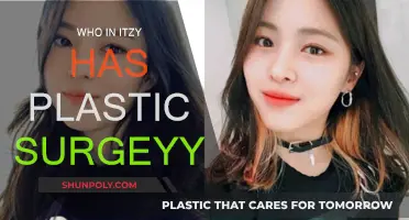 ITZY's Plastic Surgery: Who and What Procedures?