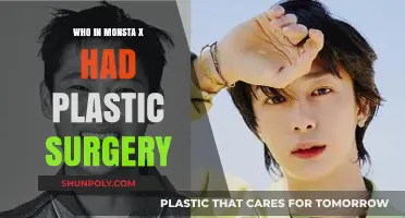 Monsta X Plastic Surgery: Which Members Enhanced Their Looks?