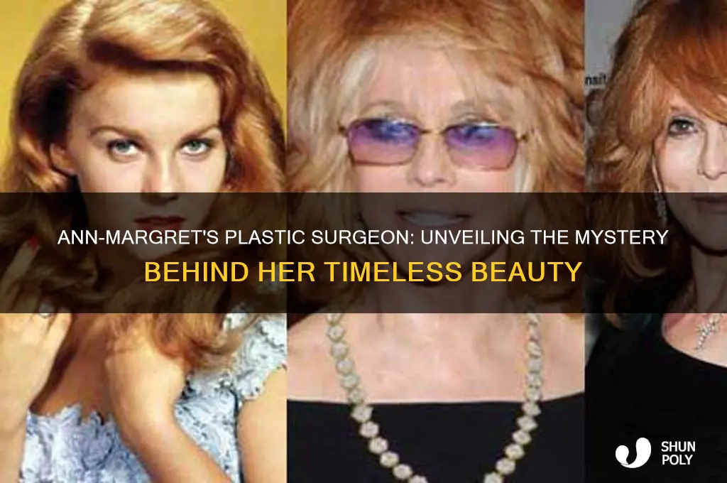 who is ann margret
