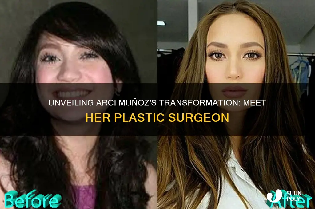 who is arci munoz plastic surgeon