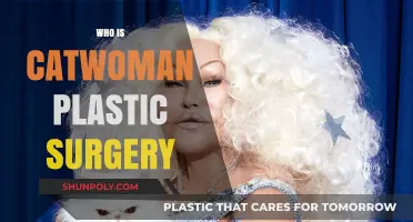Catwoman's Transformation: Unveiling the Plastic Surgery Secrets Behind the Icon