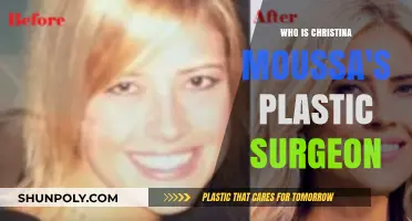Unveiling Christina Moussa's Plastic Surgeon: The Truth Behind Her Transformation