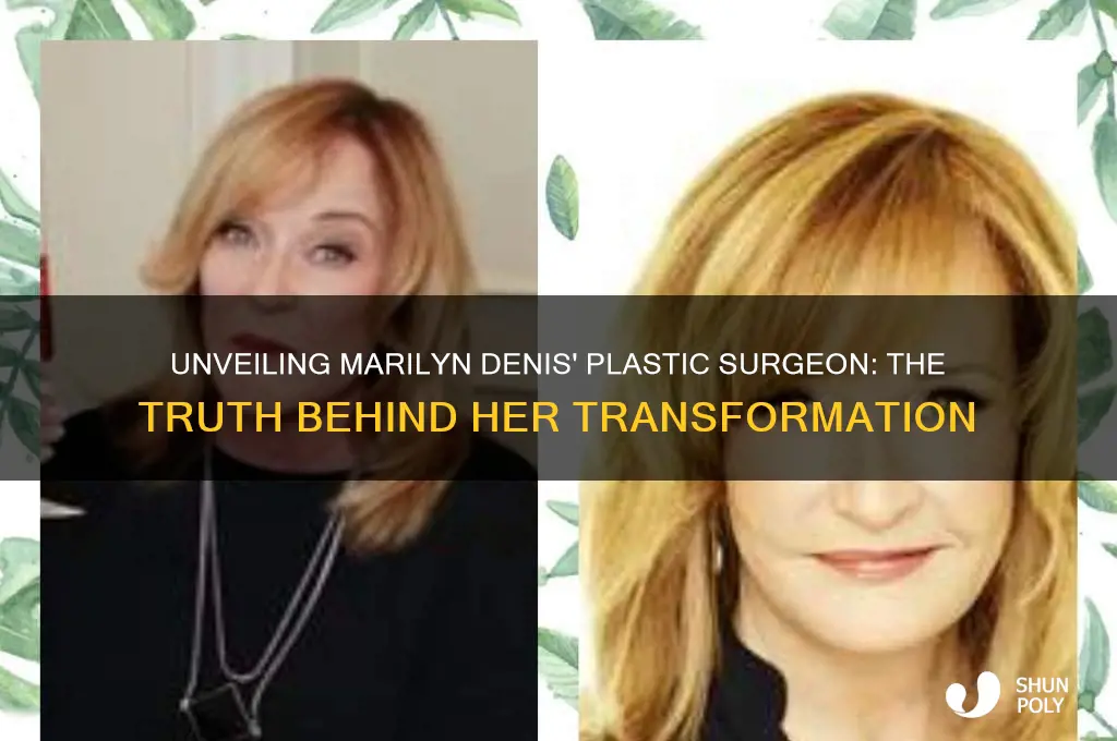who is marilyn denis plastic surgeon