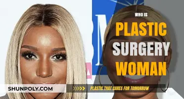 Unveiling the Story Behind the 'Plastic Surgery Woman' Phenomenon