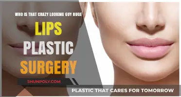 Unveiling the Story Behind the Man with Extreme Lip Surgery