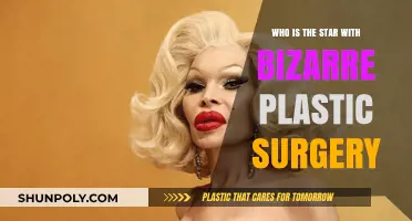 Unrecognizable Celebrities: Shocking Plastic Surgery Transformations Gone Bizarre