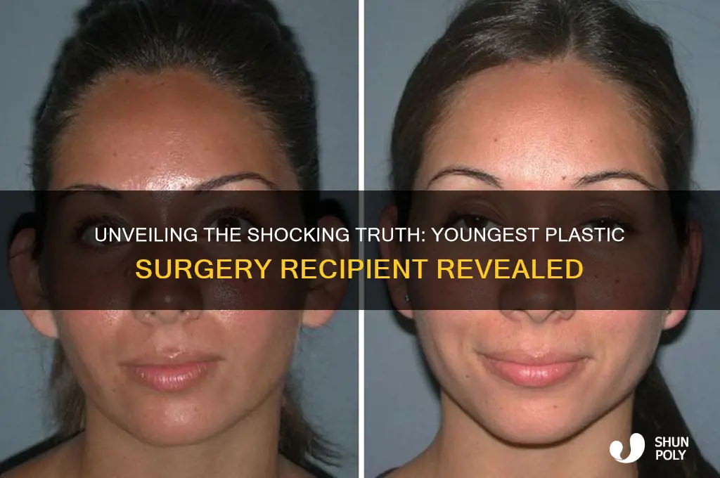who is the youngest person to get plastic surgery