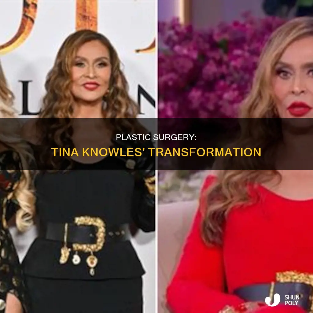 who is tina knowles plastic surgeeon