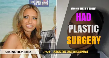 Selling Sunset Stars: Plastic Surgery Confessions and Transformations Revealed