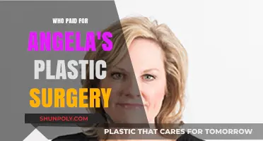 Unveiling the Mystery: Who Funded Angela's Plastic Surgery Transformation?