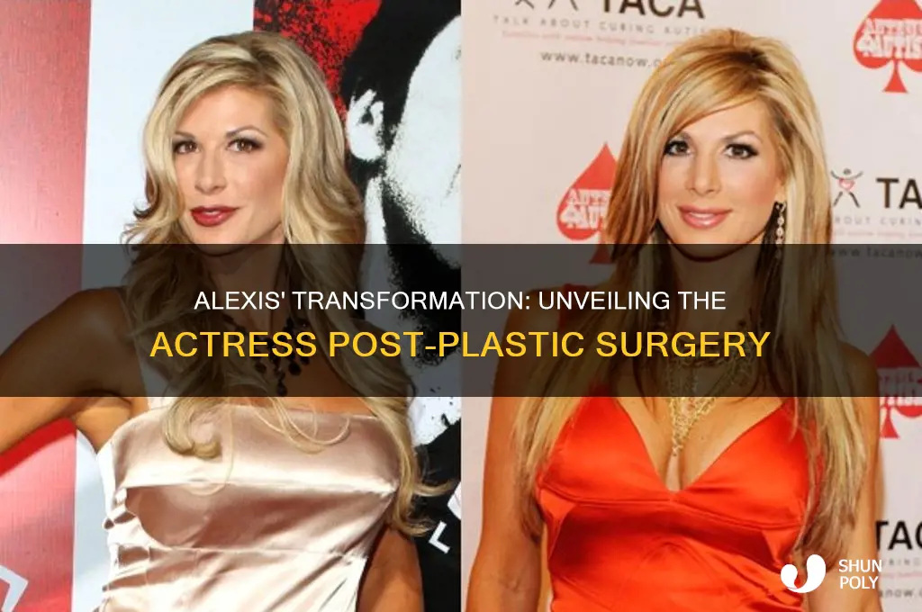 who plays alexis after plastic surgery