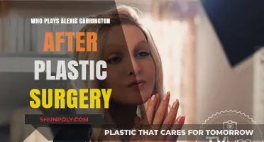 Alexis Carrington's Transformation: Post-Plastic Surgery Actress Revealed