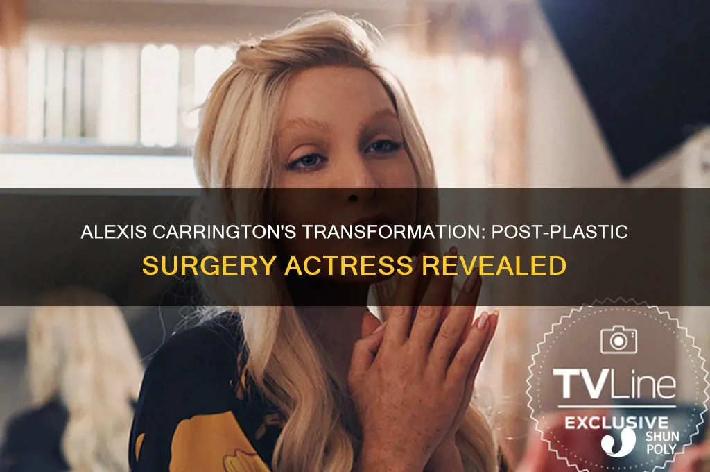 who plays alexis carrington after plastic surgery