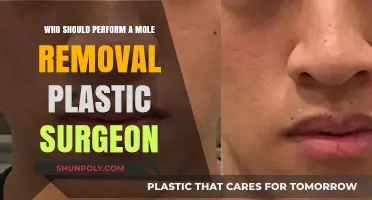Mole Removal: Why a Plastic Surgeon is Your Best Choice