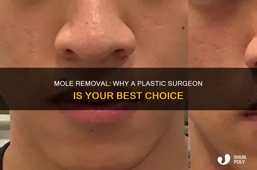 who should perform a mole removal plastic surgeon