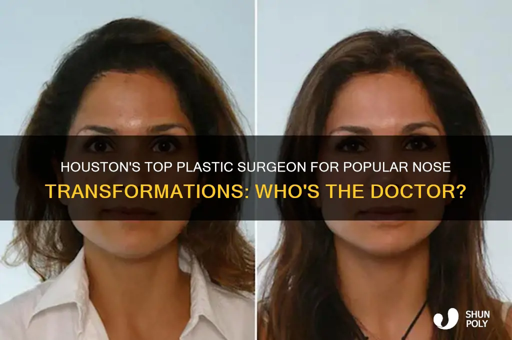 who the doctor popular plastic surgery nose in houston