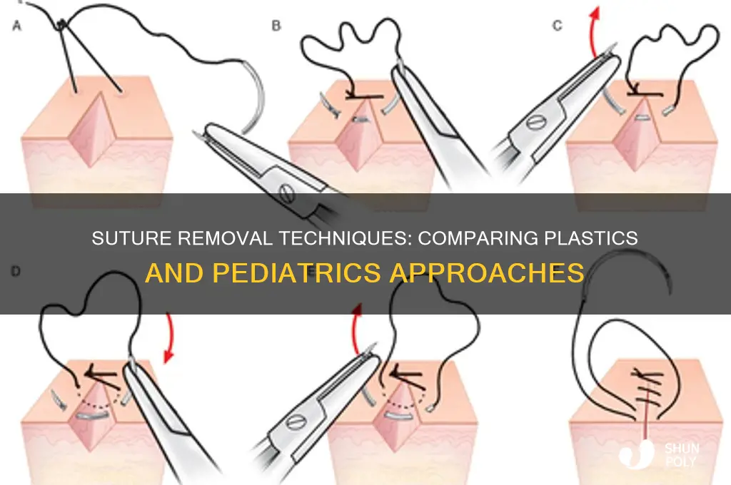 who to remove sutures plastics vs pediatrics