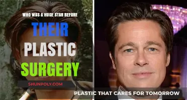 From Natural Beauty to Unrecognizable: Stars Who Changed Dramatically Post-Surgery