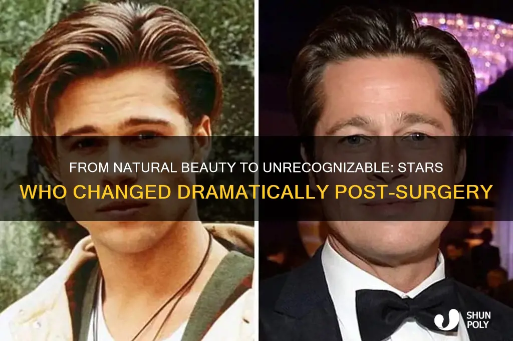 who was a huge star before their plastic surgery