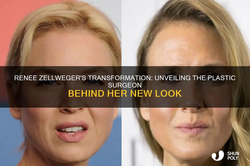 who was renee zellweger