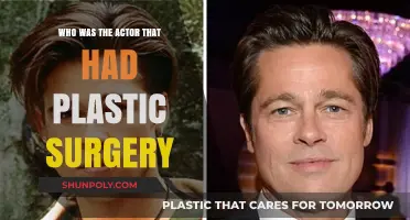 Unveiling the Actor's Transformation: Plastic Surgery Revelations and Stories