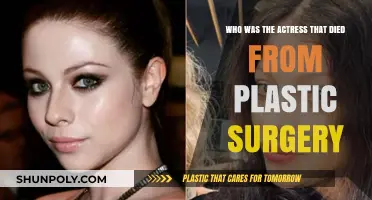 Tragic Beauty: The Actress Who Died from Plastic Surgery Complications