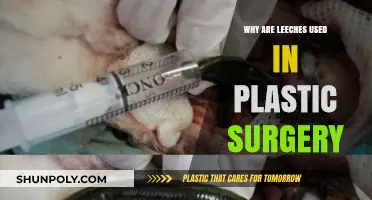 Leeches in Plastic Surgery: Unconventional Healing for Modern Procedures