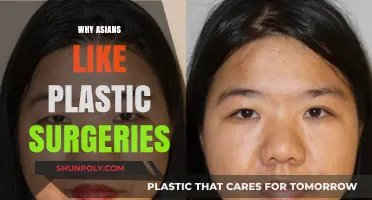 Cultural Beauty Standards: Why Many Asians Opt for Plastic Surgery