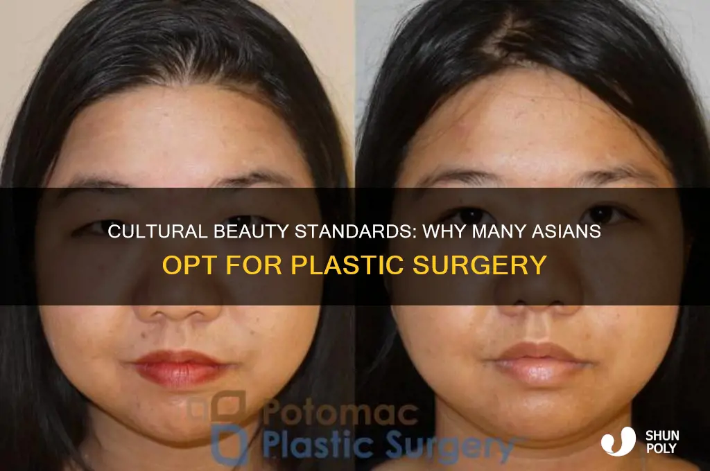 why asians like plastic surgeries