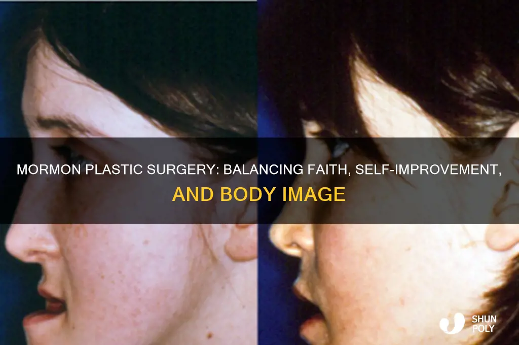 why can mormons get plastic surgery
