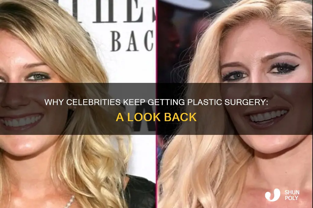why celebrities continue get plastic surgerylooks bac