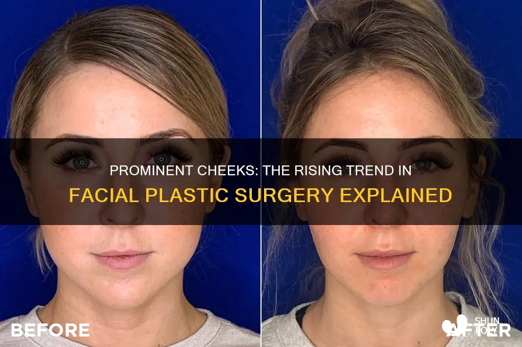 why cheeks so prominent in facial plastic surgery