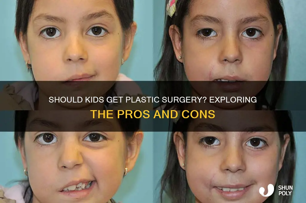 why children should get plastic surgery