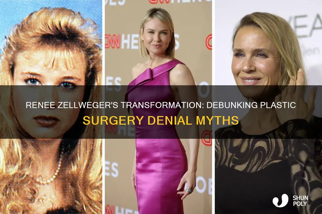 why deny renee zellweger plastic surgery