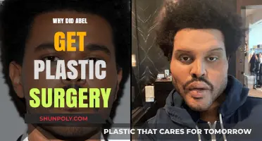 Abel's Transformation: Uncovering the Reasons Behind His Plastic Surgery Decision