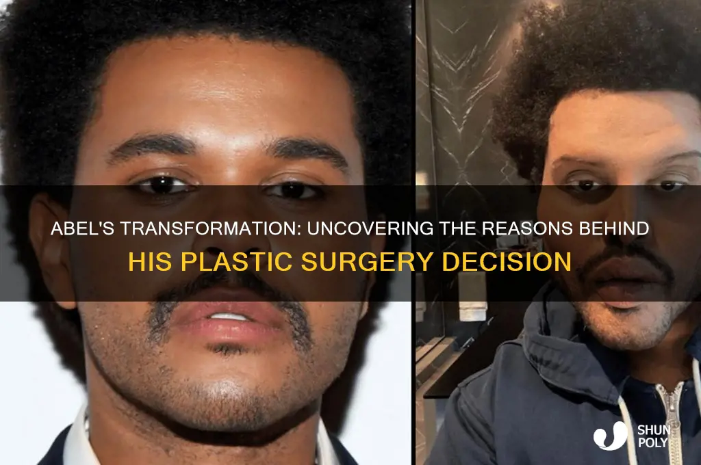 why did abel get plastic surgery