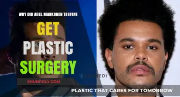 The Weeknd's Transformation: Unveiling Abel Tesfaye's Plastic Surgery Journey