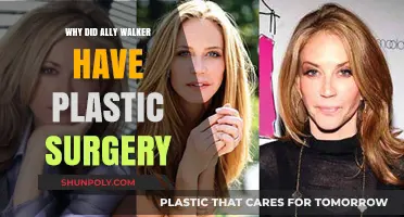 Ally Walker's Plastic Surgery: Unveiling the Reasons Behind Her Transformation