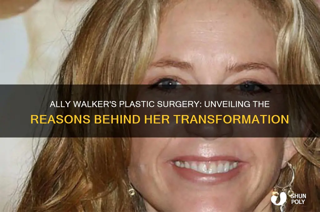 why did ally walker have plastic surgery