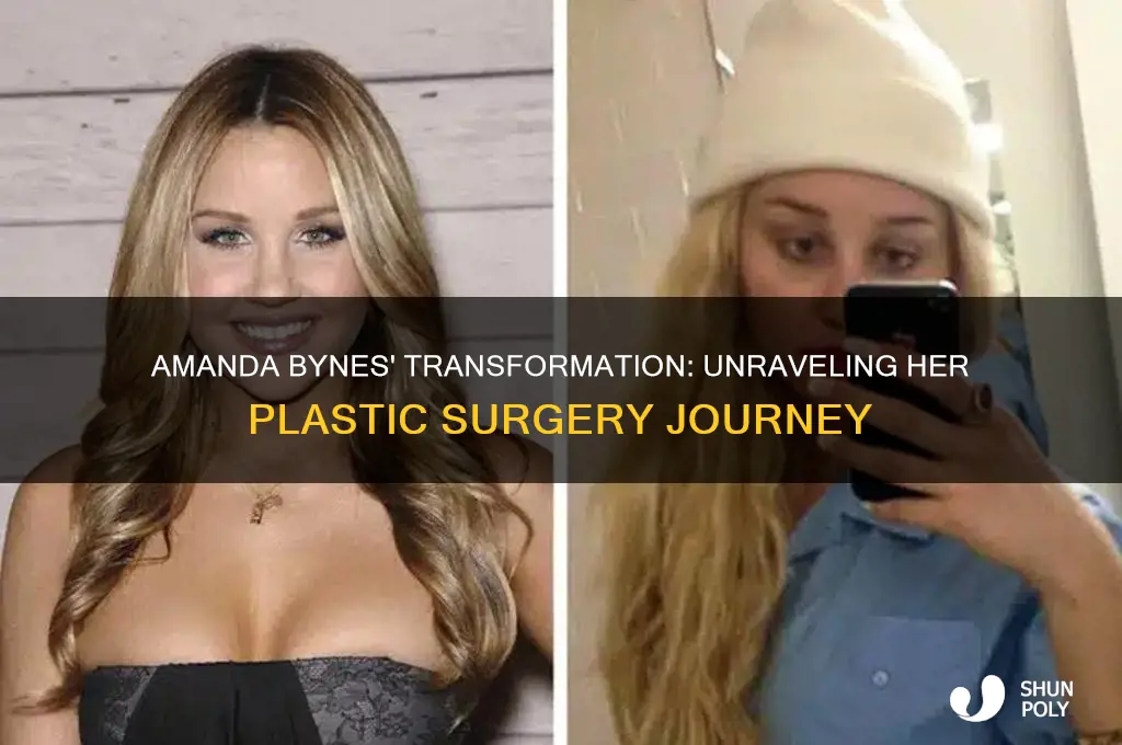 why did amanda bynes get plastic surgery