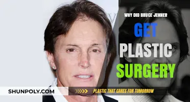 Bruce Jenner's Transformation: Unveiling the Reasons Behind Plastic Surgery