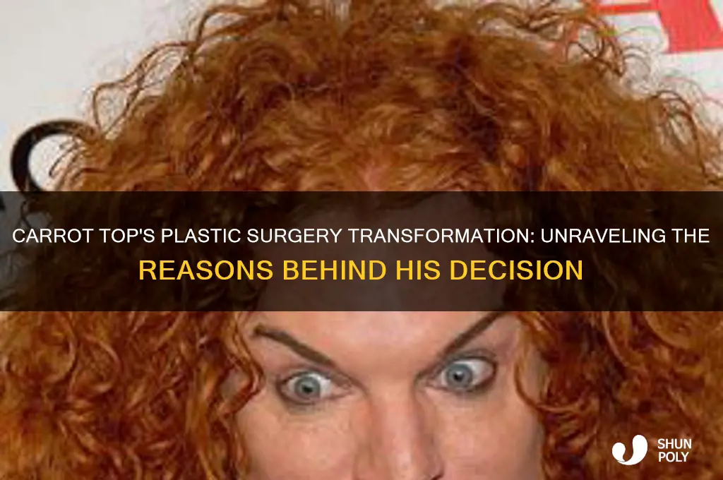 why did carrot top get plastic surgery